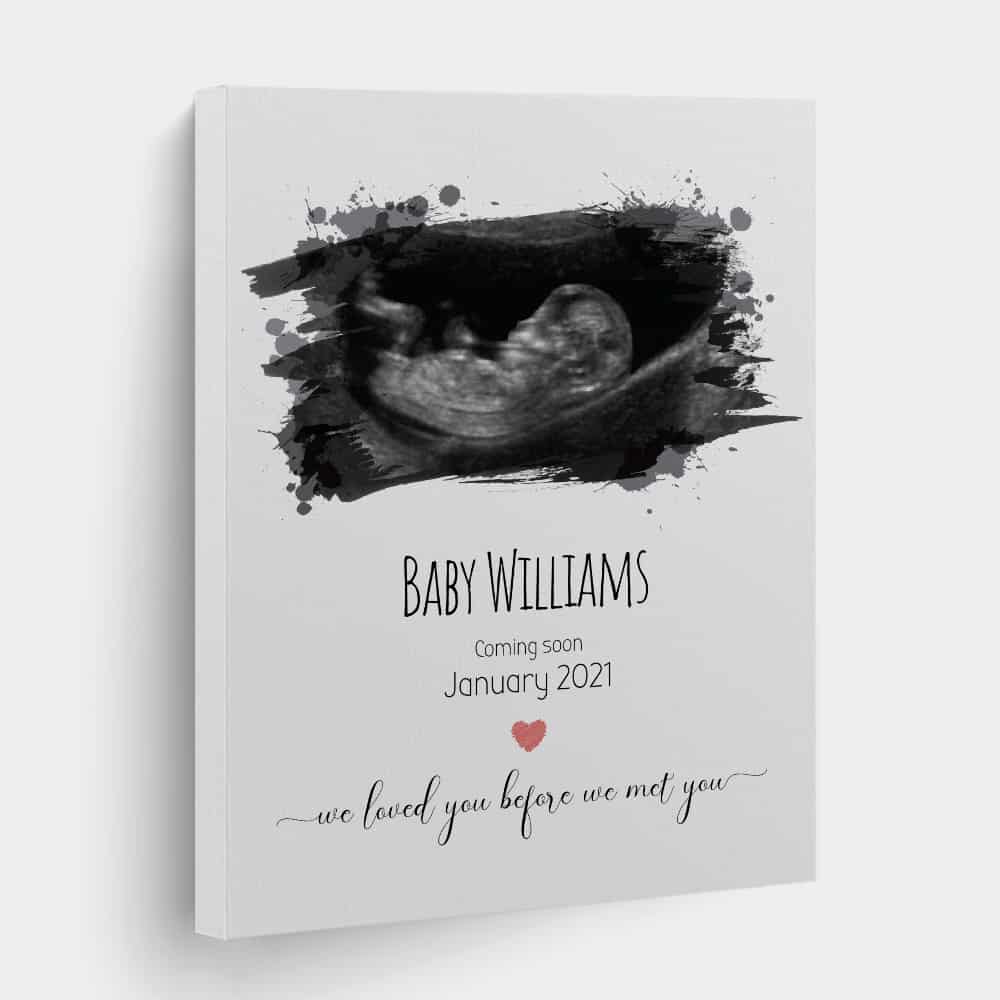We Loved You Before We Met You Photo Baby Canvas Print